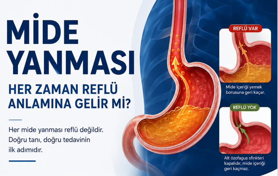 Mide Yanması Her Zaman Reflü Anlamına Gelir mi? - Prof. Dr. Samet Yardımcı