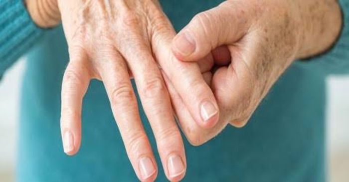 Romatizma Nedir?