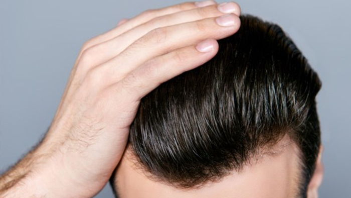 Saç Dökülmesinin Nedeni Nedir?