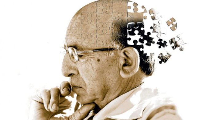 Unutkanlık- Demans (Alzheimer Hastalığı)